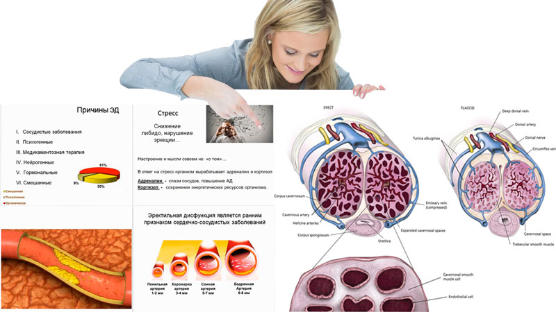 Лечение эректильной дисфункции у мужчин